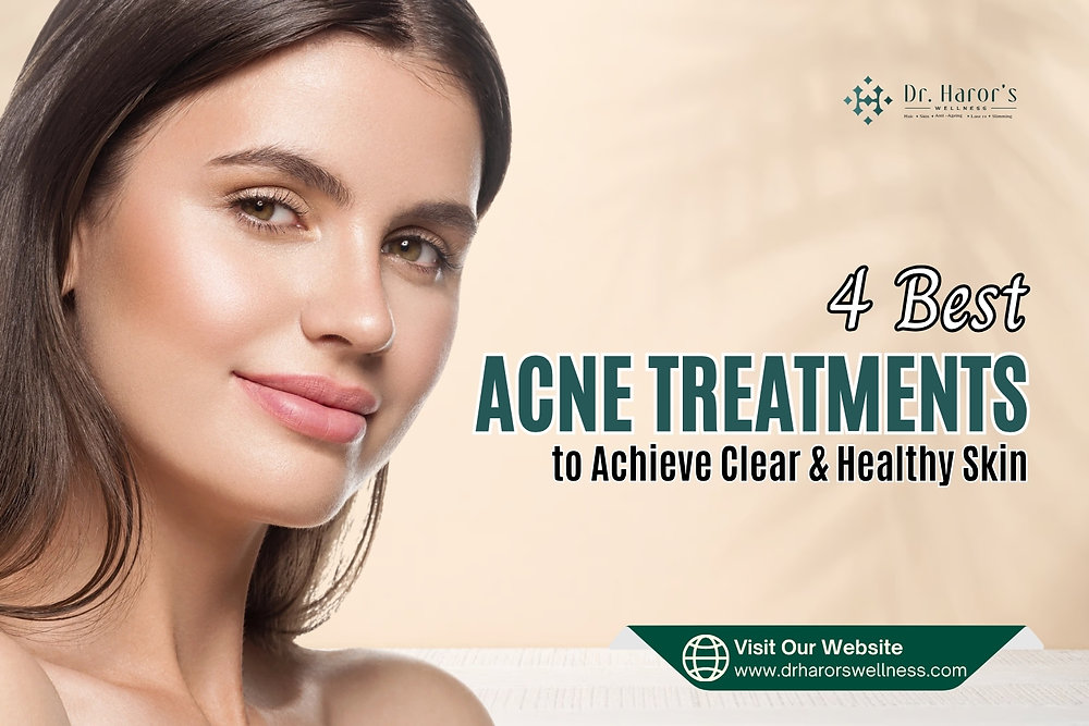 4 Best ACNE Treatments to Achieve Clear & Healthy Skin