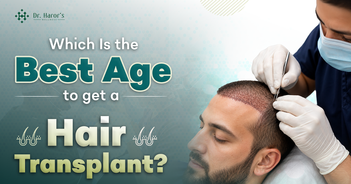 Which Is the Best Age to Get a Hair Transplant?