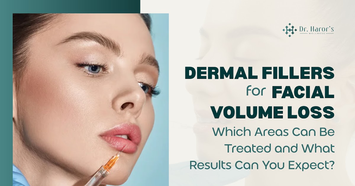 Dermal Fillers for Facial Volume Loss: Which Areas Can Be Treated and What Results Can You Expect?